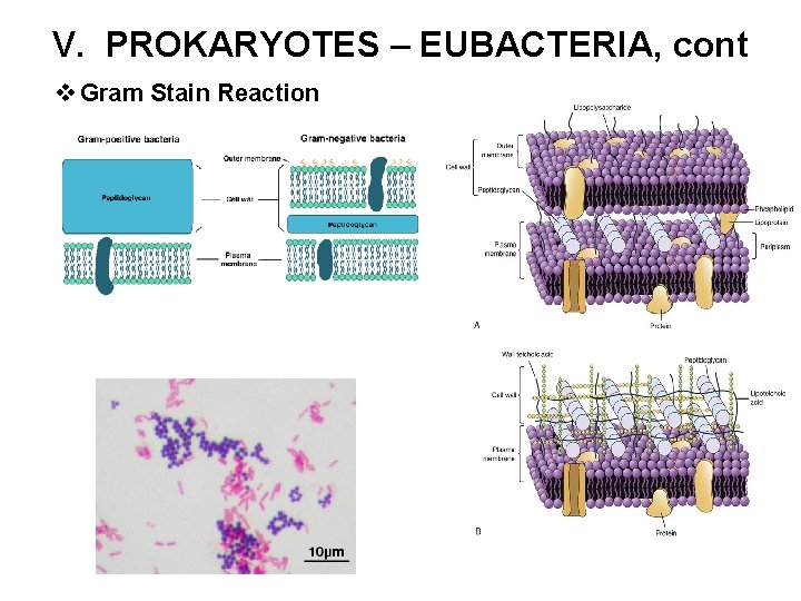 V. PROKARYOTES – EUBACTERIA, cont v Gram Stain Reaction 