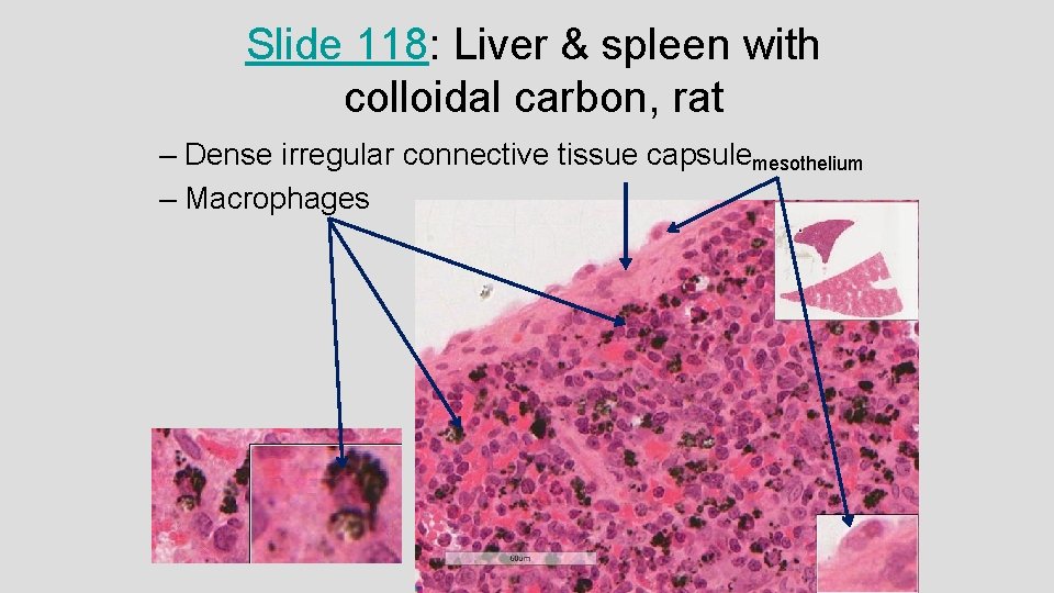 Slide 118: Liver & spleen with colloidal carbon, rat – Dense irregular connective tissue