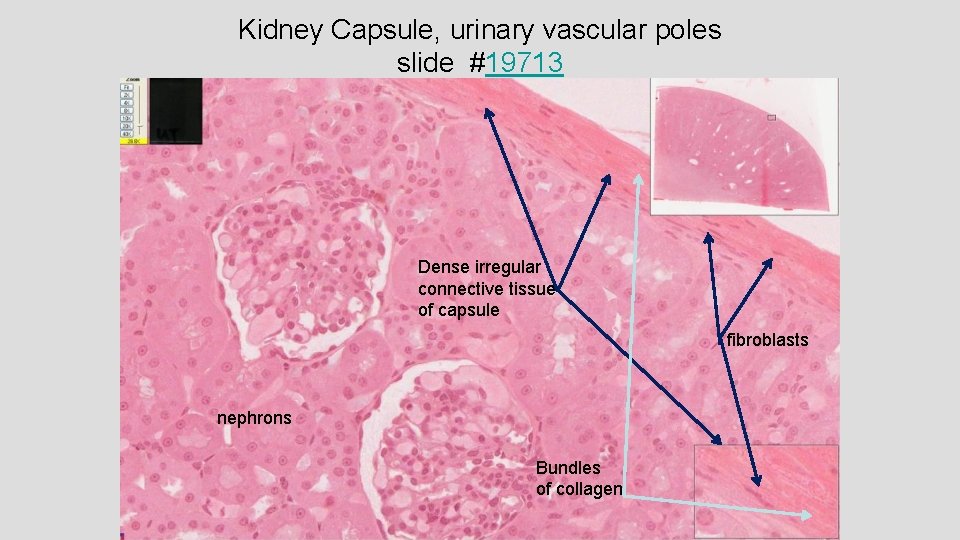 Kidney Capsule, urinary vascular poles slide #19713 Dense irregular connective tissue of capsule fibroblasts Kidney Capsule, urinary vascular poles slide #19713 Dense irregular connective tissue of capsule fibroblasts