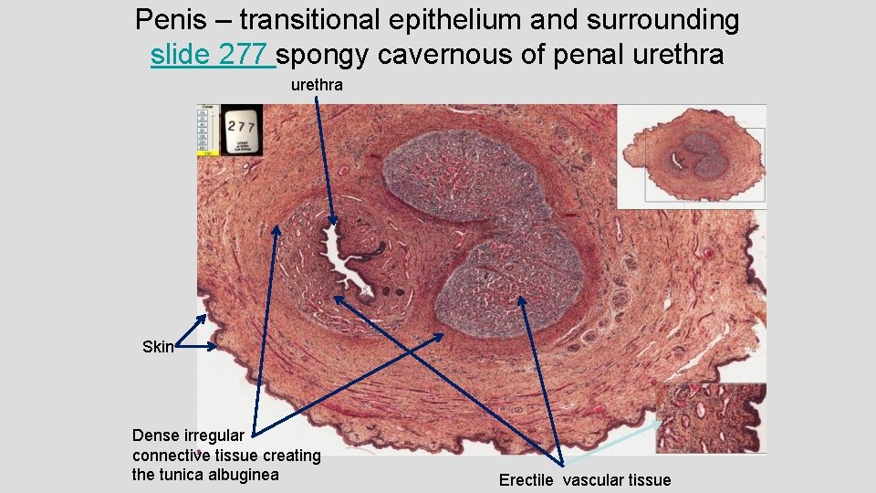 Penis – transitional epithelium and surrounding slide 277 spongy cavernous of penal urethra Skin Penis – transitional epithelium and surrounding slide 277 spongy cavernous of penal urethra Skin