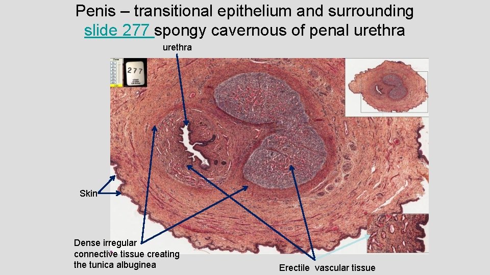 Penis – transitional epithelium and surrounding slide 277 spongy cavernous of penal urethra Skin