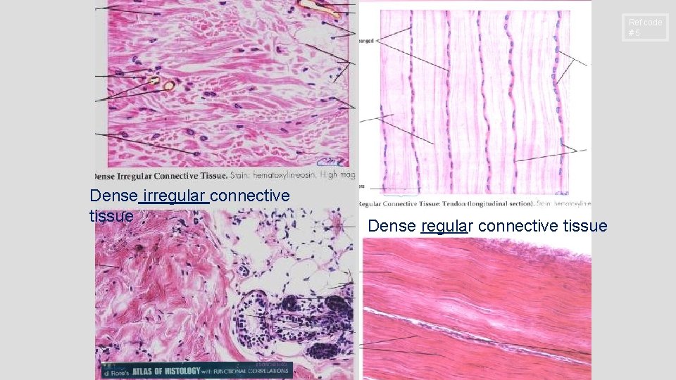 Ref code #5 Dense irregular connective tissue Dense regular connective tissue 