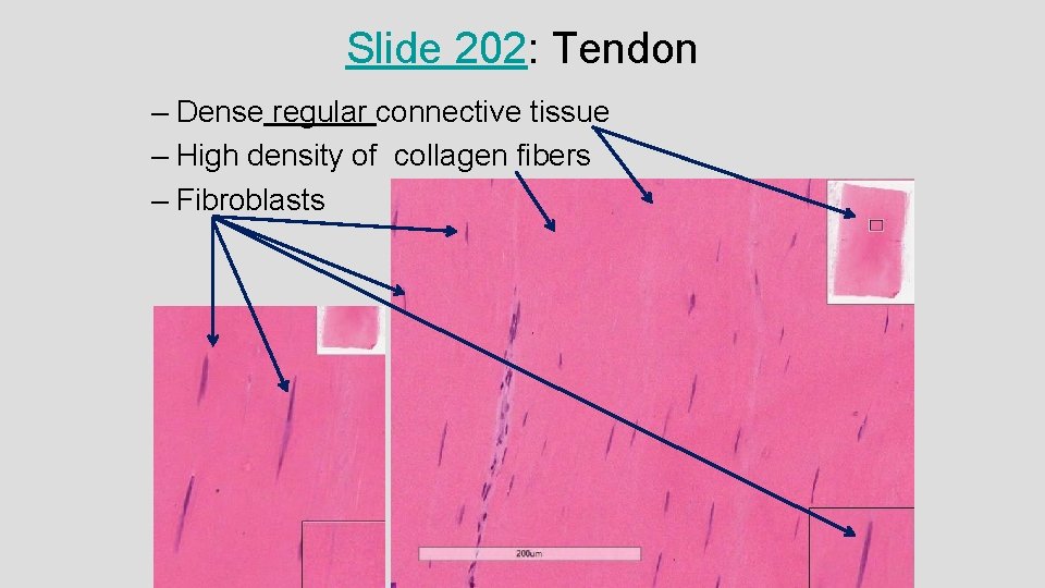 Slide 202: Tendon – Dense regular connective tissue – High density of collagen fibers