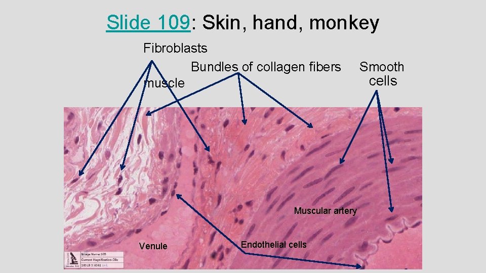 Slide 109: Skin, hand, monkey Fibroblasts Bundles of collagen fibers muscle Muscular artery Venule Slide 109: Skin, hand, monkey Fibroblasts Bundles of collagen fibers muscle Muscular artery Venule