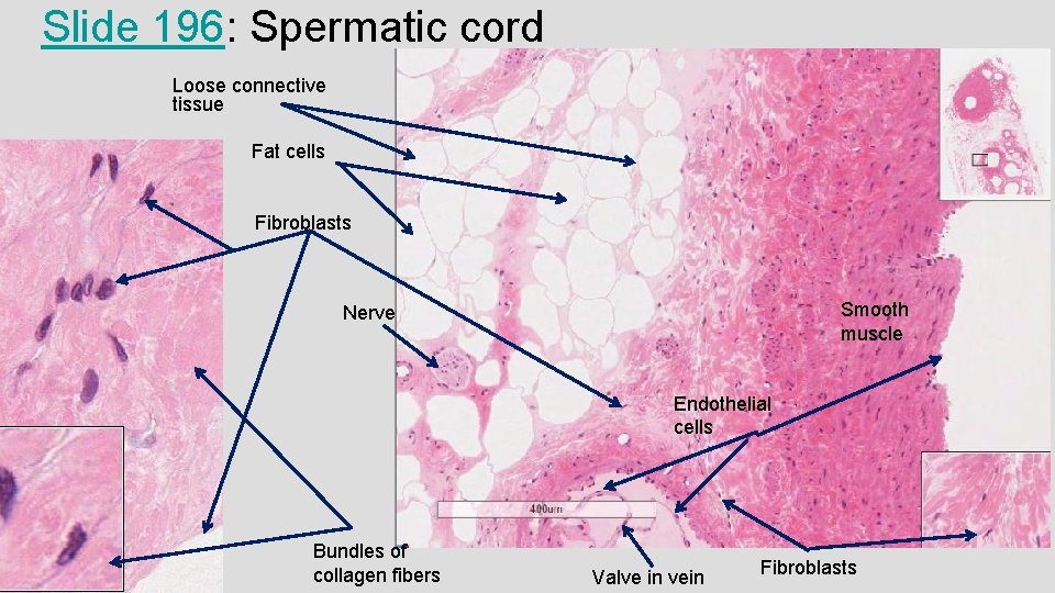 Slide 196: Spermatic cord Loose connective tissue Fat cells Fibroblasts Smooth muscle Nerve Endothelial Slide 196: Spermatic cord Loose connective tissue Fat cells Fibroblasts Smooth muscle Nerve Endothelial