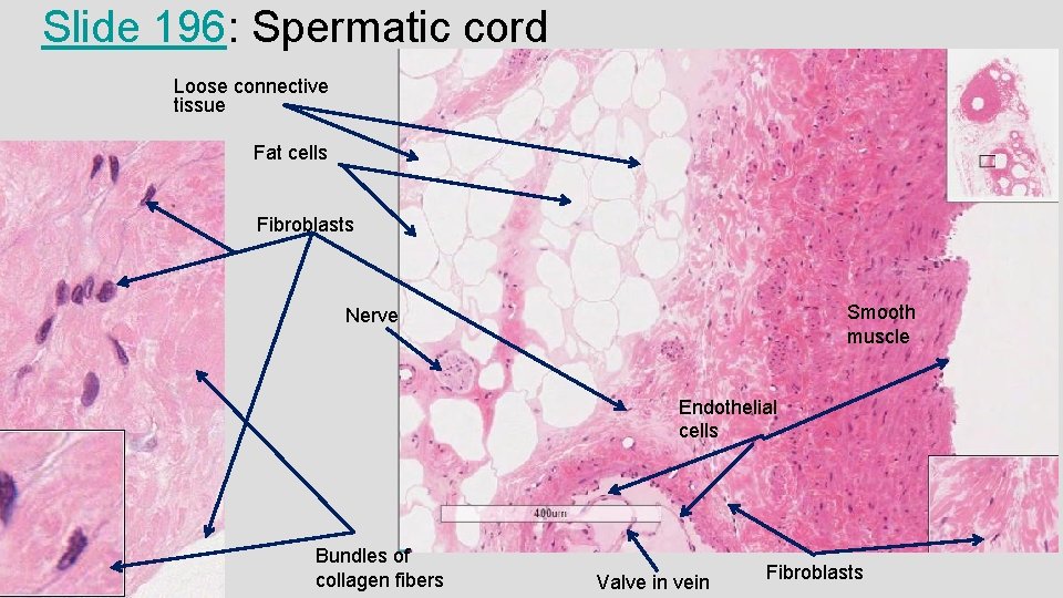 Slide 196: Spermatic cord Loose connective tissue Fat cells Fibroblasts Smooth muscle Nerve Endothelial