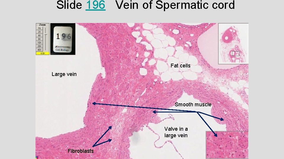 Slide 196 Vein of Spermatic cord Fat cells Large vein Smooth muscle Valve in