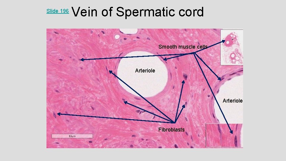 Slide 196 Vein of Spermatic cord Smooth muscle cells Arteriole Fibroblasts 