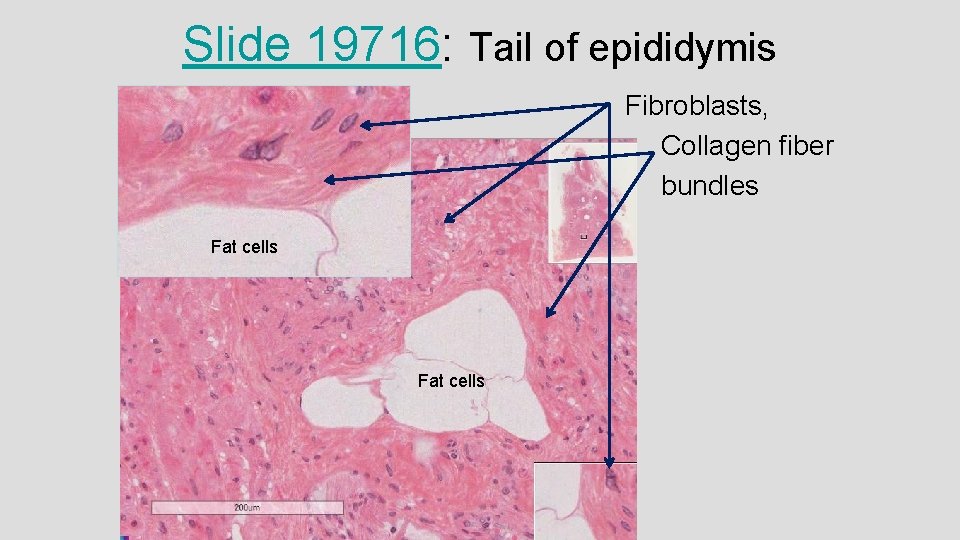 Slide 19716: Tail of epididymis Fibroblasts, Collagen fiber bundles Fat cells Slide 19716: Tail of epididymis Fibroblasts, Collagen fiber bundles Fat cells
