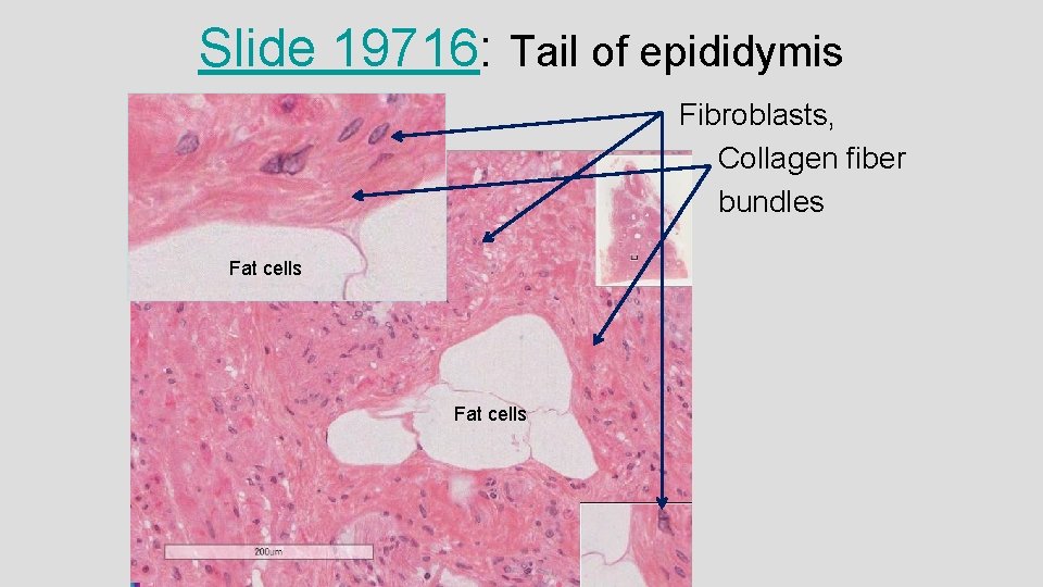 Slide 19716: Tail of epididymis Fibroblasts, Collagen fiber bundles Fat cells 