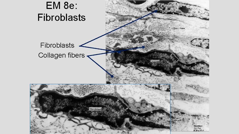 EM 8 e: Fibroblasts Collagen fibers 