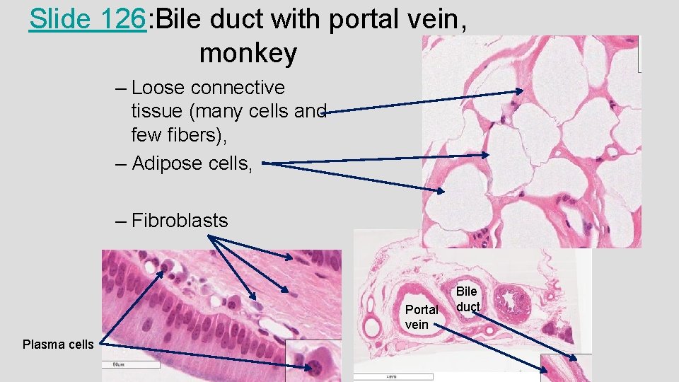 Slide 126: Bile duct with portal vein, monkey – Loose connective tissue (many cells Slide 126: Bile duct with portal vein, monkey – Loose connective tissue (many cells
