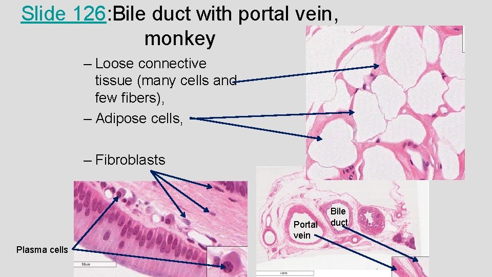 Slide 126: Bile duct with portal vein, monkey – Loose connective tissue (many cells