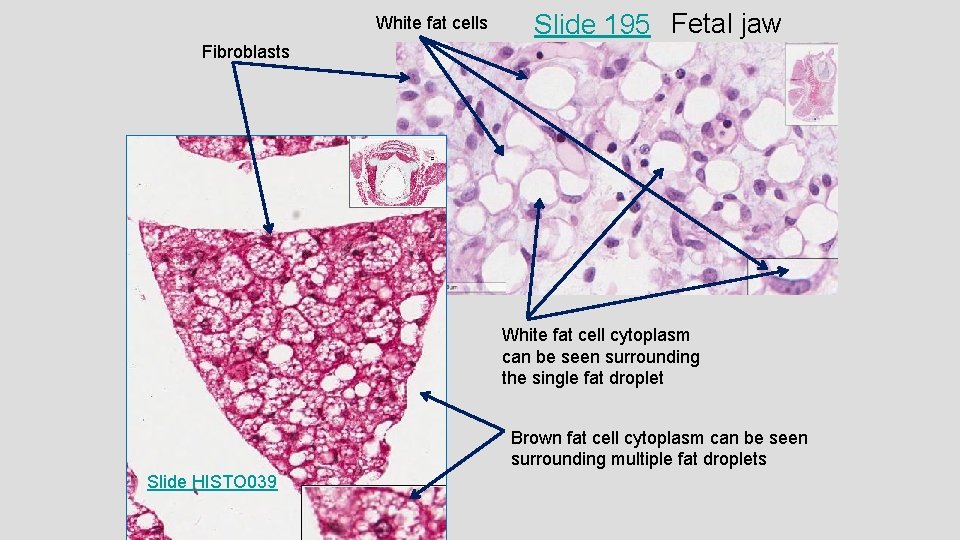 White fat cells Slide 195 Fetal jaw Fibroblasts White fat cell cytoplasm can be