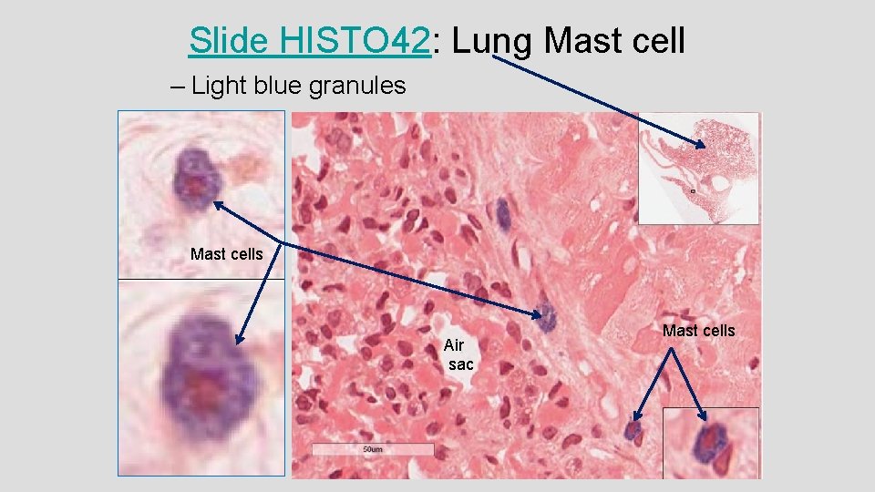 Slide HISTO 42: Lung Mast cell – Light blue granules Mast cells Air sac Slide HISTO 42: Lung Mast cell – Light blue granules Mast cells Air sac
