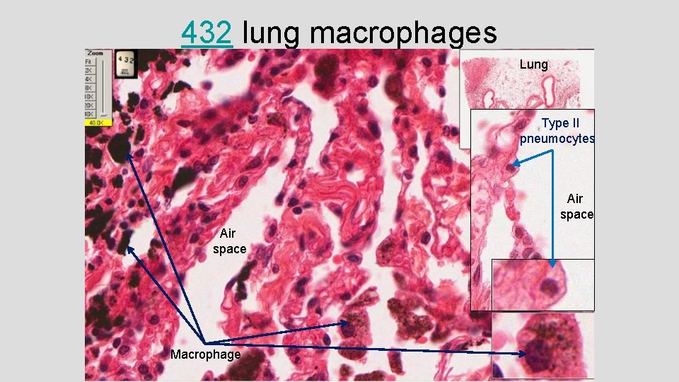 432 lung macrophages Lung Type II pneumocytes Air space Macrophage Air space 