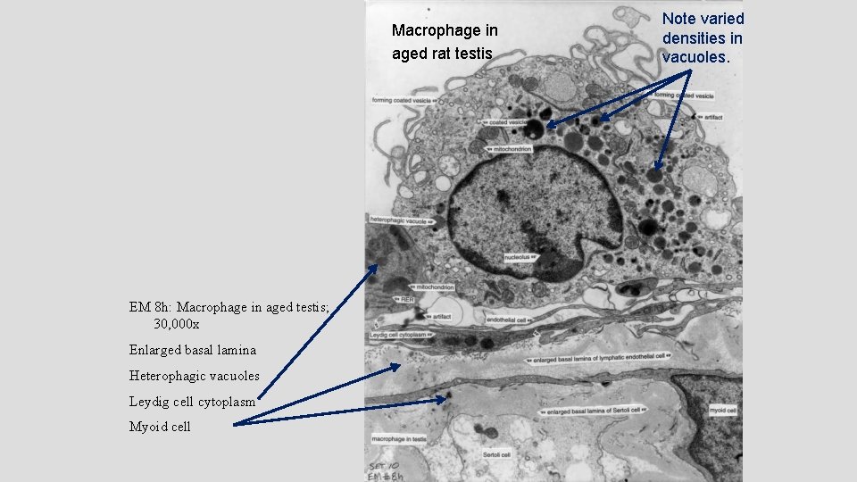 Macrophage in aged rat testis EM 8 h: Macrophage in aged testis; 30, 000 Macrophage in aged rat testis EM 8 h: Macrophage in aged testis; 30, 000