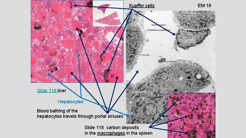 Kupffer cells Slide 118 liver Hepatocytes Blood bathing of the hepatocytes travels through portal