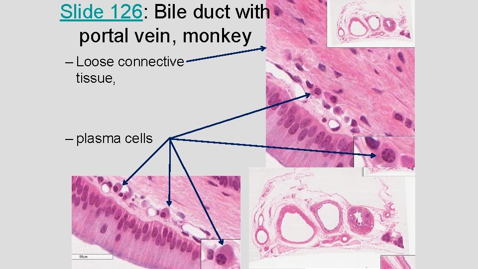 Slide 126: Bile duct with portal vein, monkey – Loose connective tissue, – plasma Slide 126: Bile duct with portal vein, monkey – Loose connective tissue, – plasma