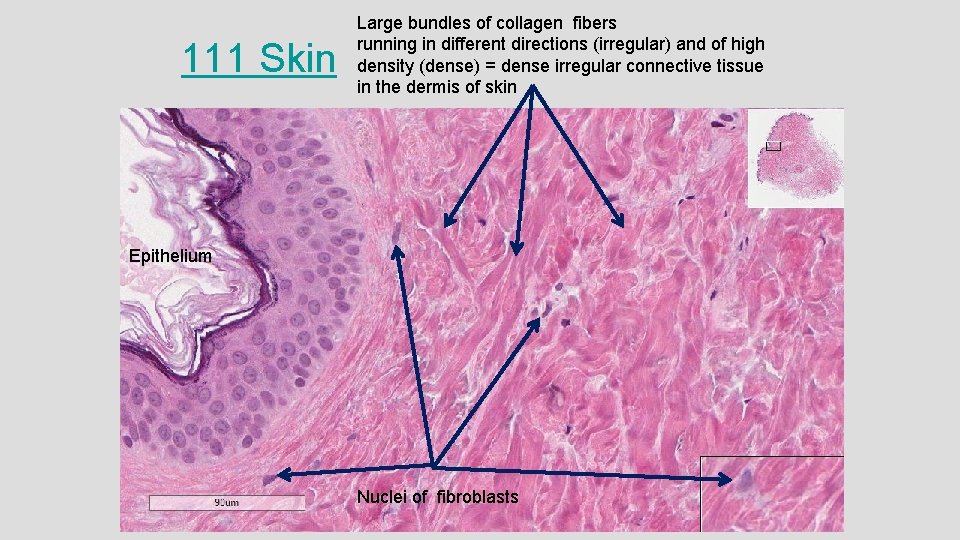 111 Skin Epithelium Large bundles of collagen fibers running in different directions (irregular) and