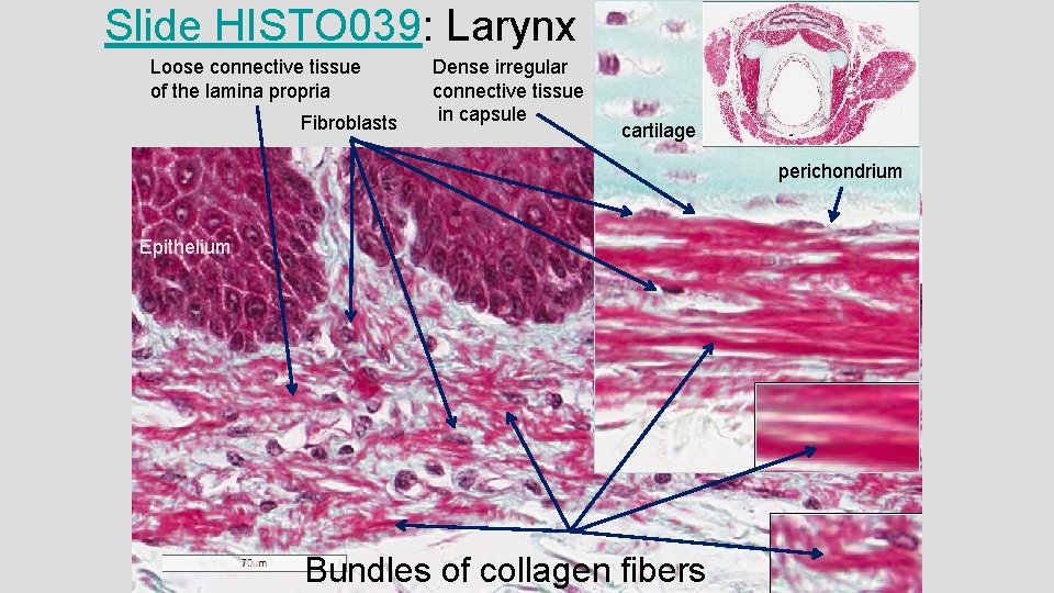 Slide HISTO 039: Larynx Loose connective tissue of the lamina propria Fibroblasts Dense irregular