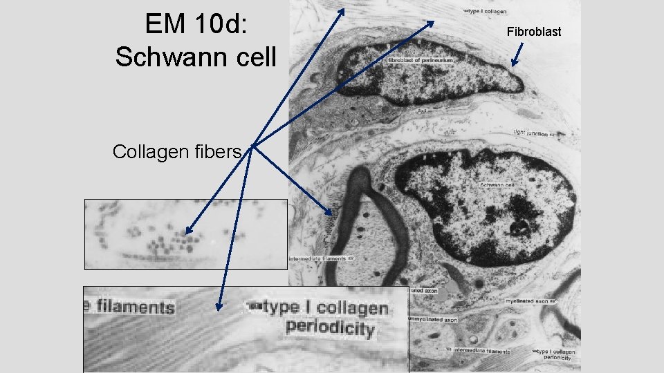 EM 10 d: Schwann cell Collagen fibers Fibroblast 