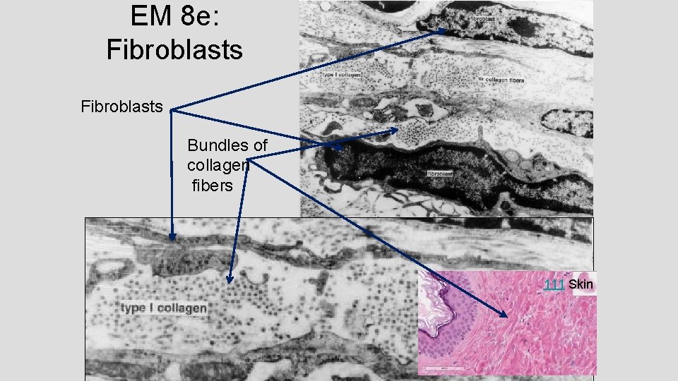 EM 8 e: Fibroblasts Bundles of collagen fibers 111 Skin EM 8 e: Fibroblasts Bundles of collagen fibers 111 Skin