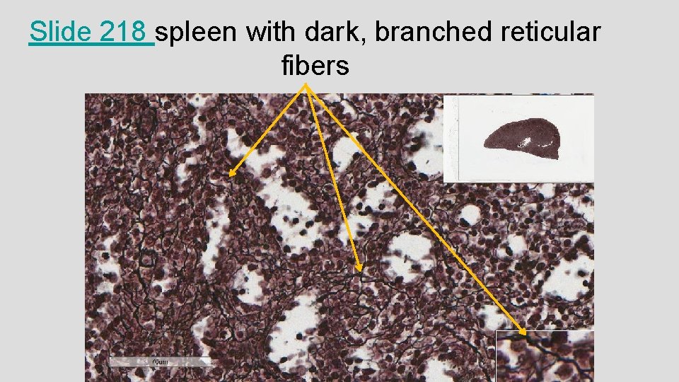 Slide 218 spleen with dark, branched reticular fibers Slide 218 spleen with dark, branched reticular fibers
