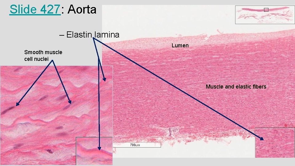 Slide 427: Aorta – Elastin lamina Lumen Smooth muscle cell nuclei Muscle and elastic