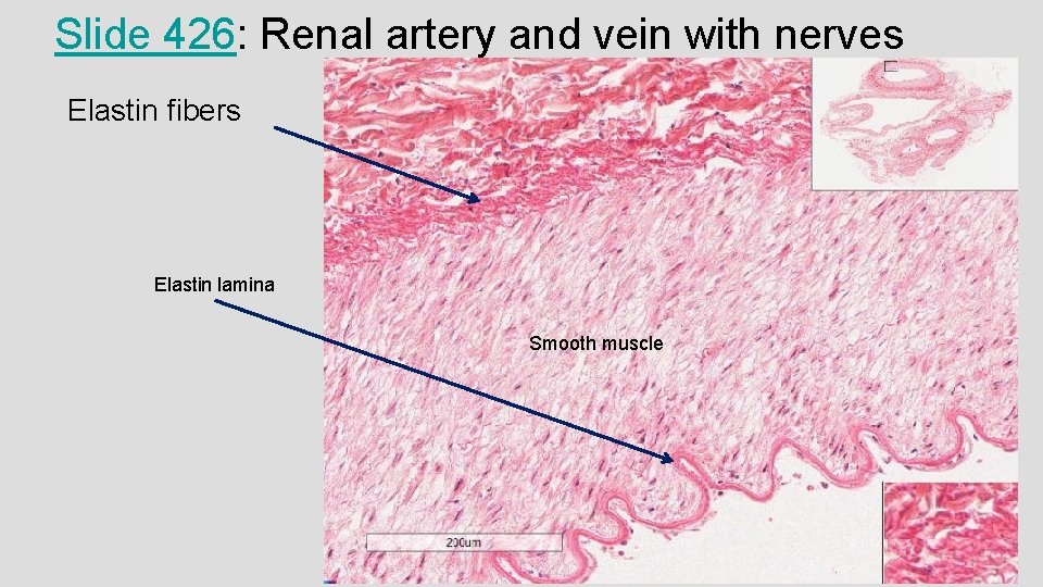 Slide 426: Renal artery and vein with nerves Elastin fibers Elastin lamina Smooth muscle Slide 426: Renal artery and vein with nerves Elastin fibers Elastin lamina Smooth muscle