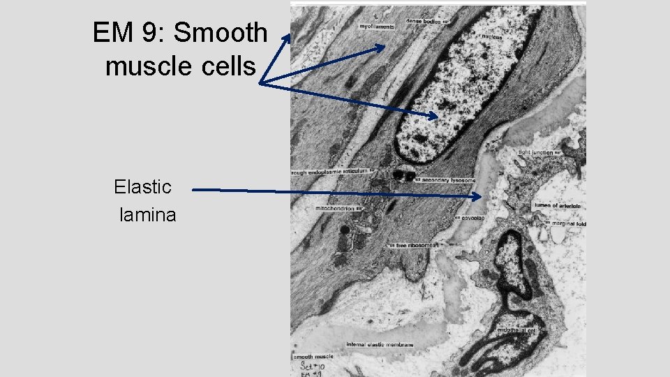 EM 9: Smooth muscle cells Elastic lamina EM 9: Smooth muscle cells Elastic lamina