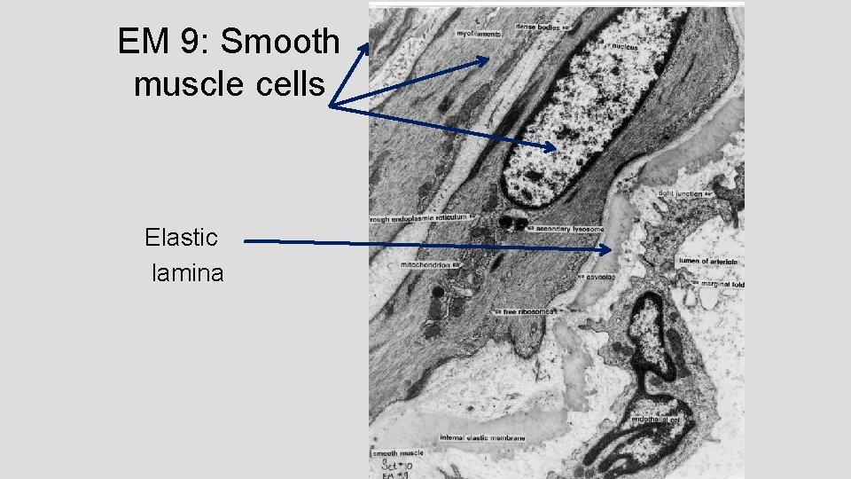 EM 9: Smooth muscle cells Elastic lamina 