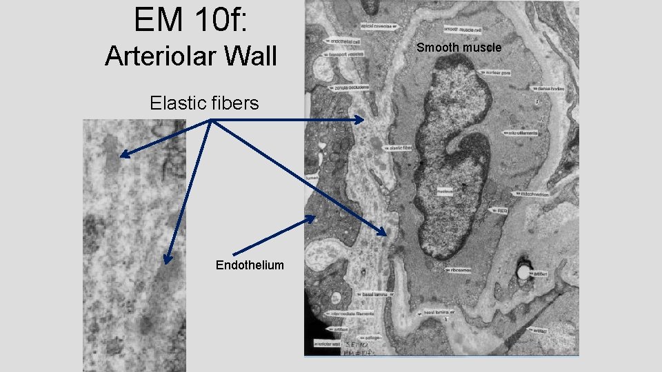 EM 10 f: Arteriolar Wall Elastic fibers Endothelium Smooth muscle 