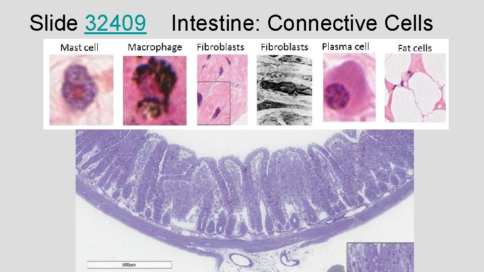 Slide 32409 Intestine: Connective Cells Slide 32409 Intestine: Connective Cells