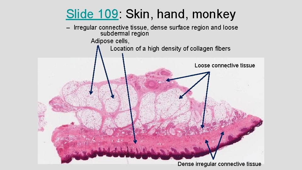 Slide 109: Skin, hand, monkey – Irregular connective tissue, dense surface region and loose Slide 109: Skin, hand, monkey – Irregular connective tissue, dense surface region and loose