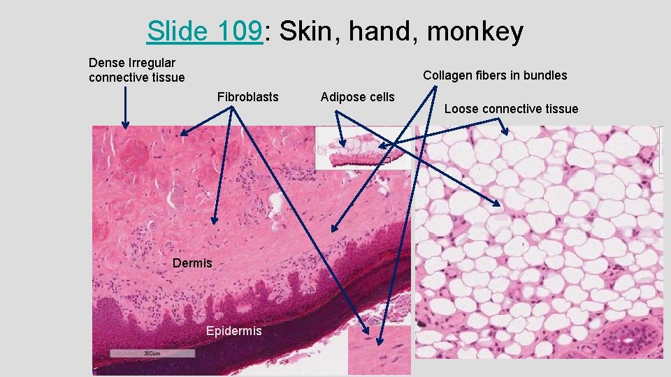 Slide 109: Skin, hand, monkey Dense Irregular connective tissue Collagen fibers in bundles Fibroblasts