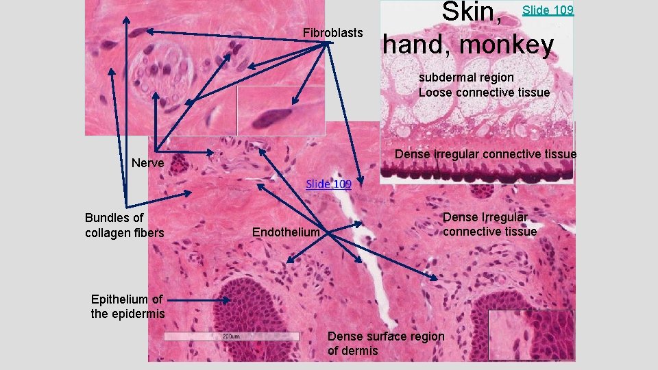 Fibroblasts Skin, Slide 109 hand, monkey subdermal region Loose connective tissue Dense irregular connective Fibroblasts Skin, Slide 109 hand, monkey subdermal region Loose connective tissue Dense irregular connective