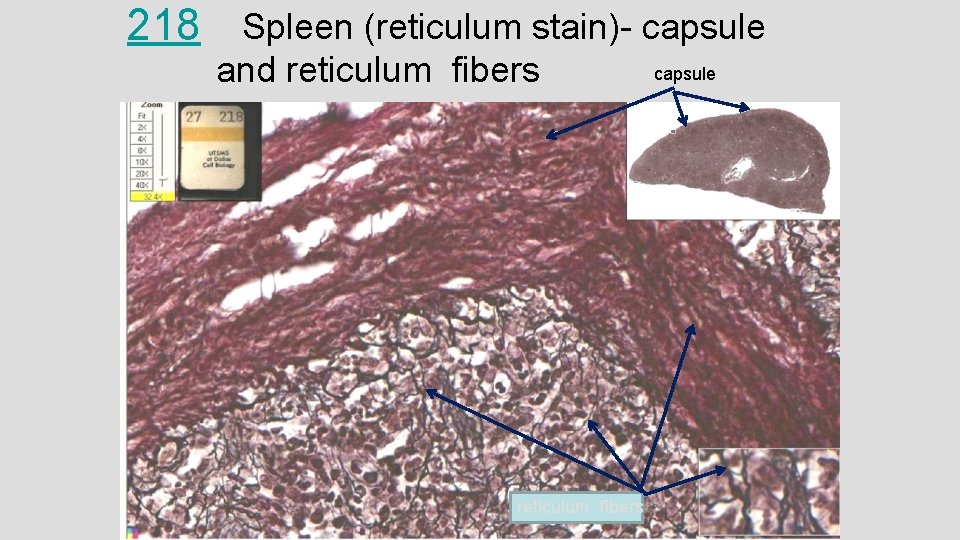 218 Spleen (reticulum stain)- capsule and reticulum fibers capsule 