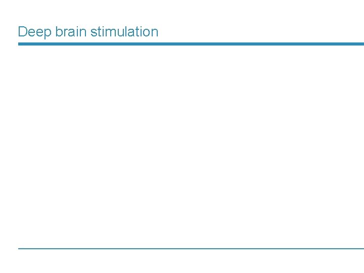 Deep brain stimulation 