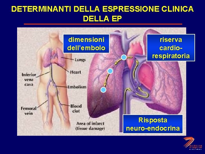 DETERMINANTI DELLA ESPRESSIONE CLINICA DELLA EP dimensioni dell’embolo riserva cardiorespiratoria Risposta neuro-endocrina 