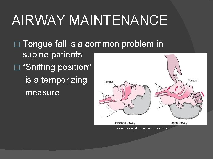 AIRWAY MAINTENANCE � Tongue fall is a common problem in supine patients � “Sniffing