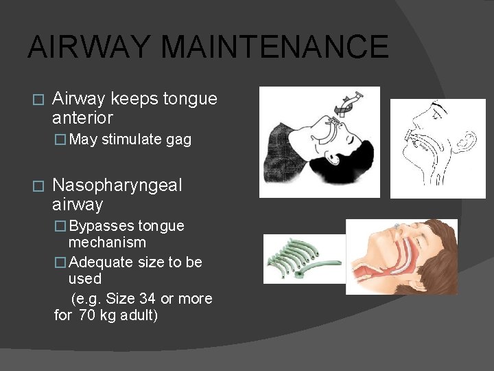 AIRWAY MAINTENANCE � Airway keeps tongue anterior � May stimulate gag � Nasopharyngeal airway