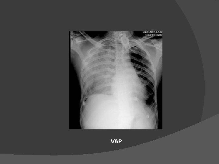 VAP 