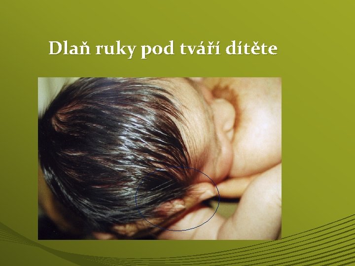 Dlaň ruky pod tváří dítěte 