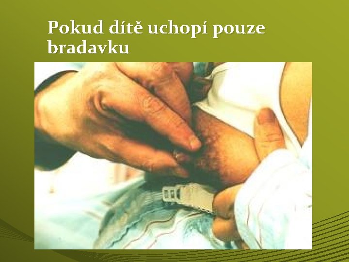 Pokud dítě uchopí pouze bradavku 