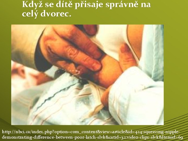 Když se dítě přisaje správně na celý dvorec. http: //nbci. ca/index. php? option=com_content&view=article&id=424: squeezing-nippledemonstrating-difference-between-poor-latch-slvk&catid=32: