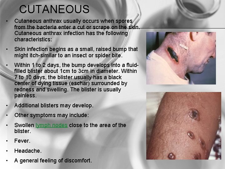 CUTANEOUS • Cutaneous anthrax usually occurs when spores from the bacteria enter a cut