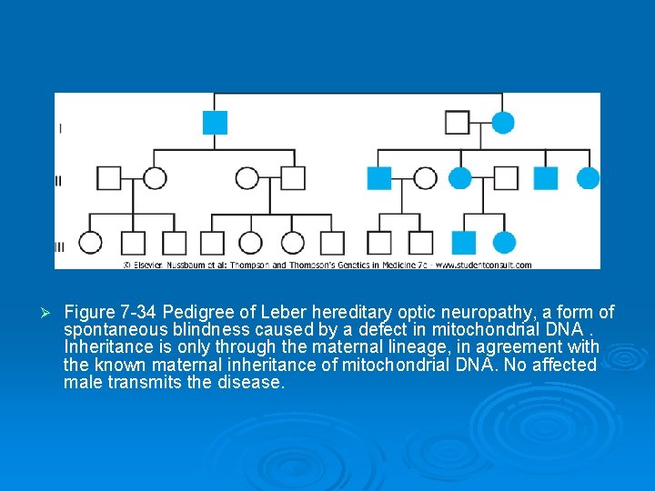 Ø Figure 7 -34 Pedigree of Leber hereditary optic neuropathy, a form of spontaneous