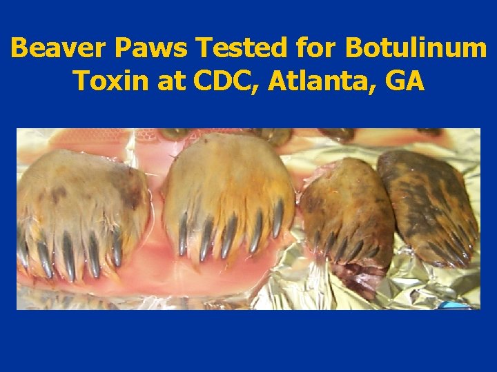 Beaver Paws Tested for Botulinum Toxin at CDC, Atlanta, GA 