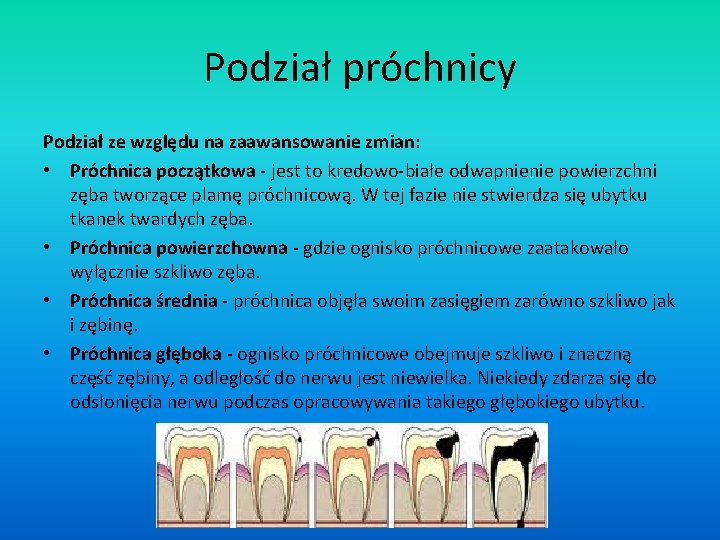 Podział próchnicy Podział ze względu na zaawansowanie zmian: • Próchnica początkowa - jest to